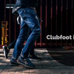 Clubfoot-in-Adults